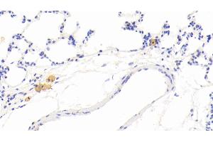 Detection of MMP12 in Rat Lung Tissue using Polyclonal Antibody to Matrix Metalloproteinase 12 (MMP12) (MMP12 anticorps  (AA 372-463))