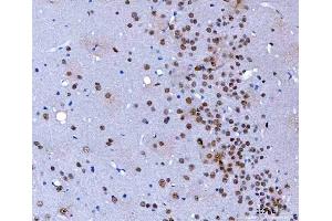 IHC analysis of HnRNP H/HNRNPH1 using anti-HnRNP H/HNRNPH1 antibody (ABIN4886623). (HNRNPH1 anticorps  (N-Term))