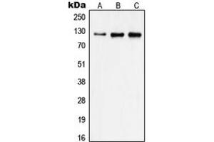 Western blot analysis of Focal Adhesion Kinase expression in A431 (A), HeLa (B), MDAMB231 (C) whole cell lysates. (FAK anticorps  (Center))