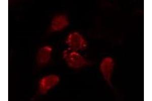 ABIN6277178 staining MCF7 by IF/ICC.