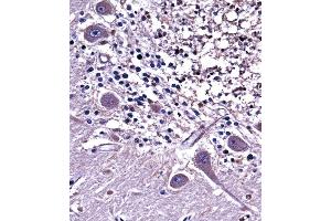 NC Antibody (C-term) ((ABIN657952 and ABIN2846897))immunohistochemistry analysis in formalin fixed and paraffin embedded human cerebellum tissue followed by peroxidase conjugation of the secondary antibody and DAB staining. (NPPC anticorps  (C-Term))