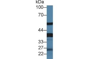 Western blot analysis of Rat Serum, using Rat FETUB Antibody (1.