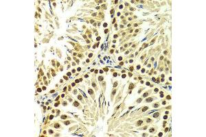 Immunohistochemistry of paraffin-embedded Rat testis using PELP1 antibody at dilution of 1:100 (x400 lens). (PELP1 anticorps  (AA 1021-1180))