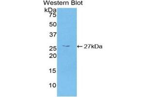Detection of Recombinant CAMK2g, Human using Polyclonal Antibody to Calcium/Calmodulin Dependent Protein Kinase II Gamma (CAMK2g) (CAMKII gamma anticorps  (AA 6-208))