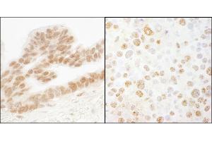 anti-Ets2 Repressor Factor (ERF) (AA 498-548) antibody