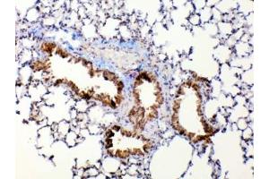 IHC testing of FFPE mouse lung tissue with Mmp13 antibody at 1ug/ml.