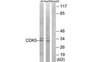 Western blot analysis of extracts from HepG2/Jurkat cells, using CDK5 (Ab-15) Antibody. (CDK5 anticorps  (AA 1-50))