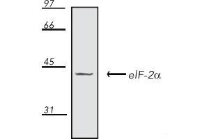 Western Blotting (WB) image for anti-Eukaryotic Translation Initiation Factor 2A, 65kDa (EIF2A) antibody (ABIN7211398)