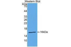Western blot analysis of the recombinant protein. (Renin anticorps  (AA 67-179))