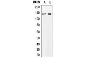 Western blot analysis of MN1 expression in K562 (A), NIH3T3 (B) whole cell lysates. (Meningioma 1 anticorps  (Center))