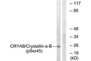 Western blot analysis of extracts from COS7 cells treated with anisomycin 25ug/ml 30', using CRYAB (Phospho-Ser45) Antibody. (CRYAB anticorps  (pSer45))