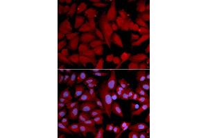 Immunofluorescence (IF) image for anti-Proteasome Subunit alpha 4 (PSMA4) (AA 1-261) antibody (ABIN3023325)