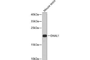 Western blot analysis of extracts of mouse testis, using DN antibody (ABIN6127820, ABIN6139729, ABIN6139731 and ABIN6224283) at 1:1000 dilution. (DNAL1 anticorps  (AA 41-190))