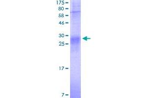 Image no. 1 for Tumor Necrosis Factor (Ligand) Superfamily, Member 4 (TNFSF4) (AA 52-183) protein (His-DYKDDDDK-Strep II Tag) (ABIN1323245)