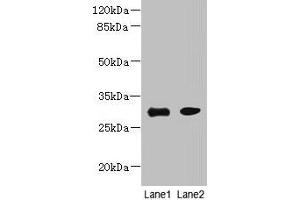 Western blot All lanes: PI4KAP1 antibody at 10 μg/mL Lane 1: Mouse gonadal tissue Lane 2: 293T whole cell lysate Secondary Goat polyclonal to rabbit IgG at 1/10000 dilution Predicted band size: 30 kDa Observed band size: 30 kDa (PI4KAP1 anticorps  (AA 1-262))