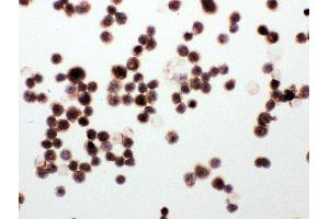 Anti-WISP1 antibody, ICC ICC: MCF-7 Cell