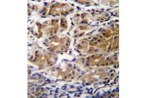 Immunohistochemistry analysis in formalin fixed and paraffin embedded human stomach tissue reacted with PDPR Antibody (C-term) followed by peroxidase conjugation of the secondary antibody and DAB staining.