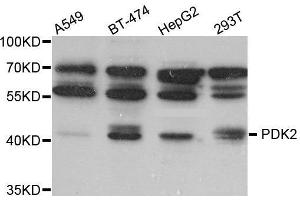 Western Blotting (WB) image for anti-Pyruvate Dehydrogenase Kinase, Isozyme 2 (PDK2) (AA 128-407) antibody (ABIN1681304)
