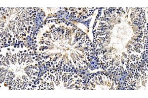 Detection of TBK1 in Mouse Testis Tissue using Polyclonal Antibody to TANK Binding Kinase 1 (TBK1) (TBK1 anticorps  (AA 9-310))