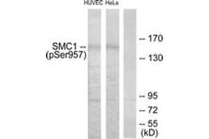 Western blot analysis of extracts from HuvEc cells treated with EGF 200ng/ml 5'/HeLa cells treated with EGF 200ng/ml 15', using SMC1 (Phospho-Ser957) Antibody. (SMC1A anticorps  (pSer957))