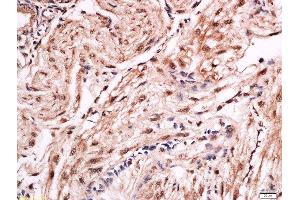 Formalin-fixed and paraffin embedded rat placenta labeled with Anti-FOXF1 Polyclonal Antibody, Unconjugated  at 1:200 followed by conjugation to the secondary antibody and DAB staining. (FOXF1 anticorps  (AA 285-379))