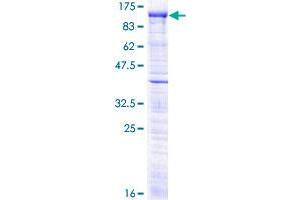 MCPH1 Protein (AA 1-610) (GST tag)