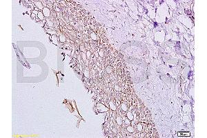 Formalin-fixed and paraffin embedded rat ovary tissue labeled with Anti-Inhibin Alpha Polyclonal Antibody, Unconjugated (ABIN736656) at 1:200, followed by conjugation to the secondary antibody and DAB staining (Inhibin alpha anticorps  (AA 301-366))