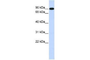 Human Muscle; WB Suggested Anti-ZXDA Antibody Titration: 0. (ZXDA anticorps  (Middle Region))