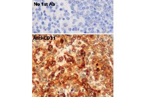 Immunohistochemistry (IHC) image for anti-Platelet/endothelial Cell Adhesion Molecule (PECAM1) (C-Term) antibody (ABIN6254202) (CD31 anticorps  (C-Term))