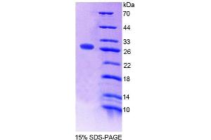 Image no. 1 for ATR serine/threonine kinase (ATR) (AA 25-214) protein (T7 tag,His tag) (ABIN6239504) (ATR Protein (AA 25-214) (T7 tag,His tag))