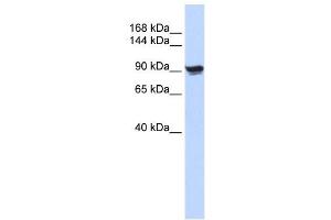 Alpha Actinin 1 antibody used at 1 ug/ml to detect target protein.
