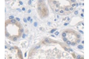 Detection of ME2 in Human Kidney Tissue using Polyclonal Antibody to Malic Enzyme 2, NADP+ Dependent, Mitochondrial (ME2) (Malic Enzyme 2, NADP+ Dependent, Mitochondrial (AA 220-426) anticorps)