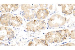Detection of INHbA in Human Stomach Tissue using Polyclonal Antibody to Inhibin Beta A (INHbA) (INHBA anticorps  (AA 311-426))