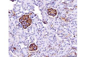IHC analysis of CD147/Emmprin using anti-CD147/Emmprin antibody (ABIN7599998).