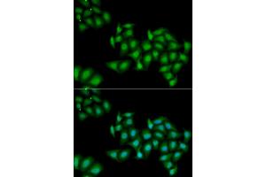 Immunofluorescence analysis of HeLa cells using DDX1 antibody (ABIN5973950). (DDX1 anticorps)