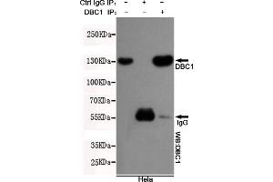 Immunoprecipitation analysis of Hela cell lysates using DBC1 mouse mAb.