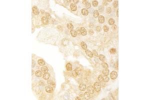 Immunohistochemistry (IHC) image for anti-Ankyrin Repeat Domain 17 (ANKRD17) (AA 1550-1600) antibody (ABIN7454418)