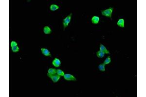 Immunofluorescence staining of SH-SY5Y cells with ABIN7161398 at 1:200, counter-stained with DAPI.