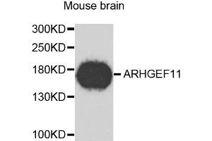 Western blot analysis of extracts of mouse brain, using ARHGEF11 antibody. (ARHGEF11 anticorps)