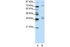 WB Suggested Anti-AKAP9  Antibody Titration: 1.