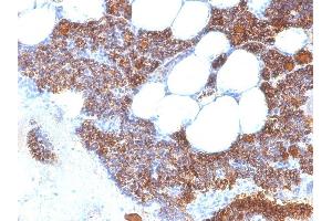 Formalin-fixed, paraffin-embedded human Parathyroid stained with PTH Mouse Monoclonal Antibody (SPM604). (PTH anticorps  (AA 1-34))