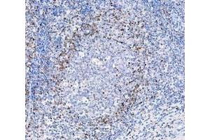 IHC analysis of ADK using anti-ADK antibody (ABIN4886430). (ADK anticorps  (AA 165-351))