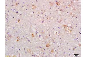Formalin-fixed and paraffin embedded rat brain labeled with Anti-Gas1 Polyclonal Antibody, Unconjugated (ABIN872751) at 1:200 followed by conjugation to the secondary antibody and DAB staining. (GAS1 anticorps  (AA 101-200))