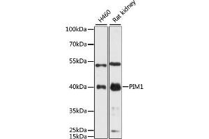 Western blot analysis of extracts of various cell lines, using PIM1 antibody (ABIN6128456, ABIN6145654, ABIN6145656 and ABIN6218499) at 1:3000 dilution. (PIM1 anticorps  (AA 1-313))