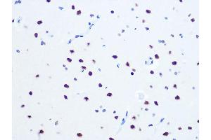 Immunohistochemistry of paraffin-embedded rat brain using DHX9/DHX9/RNA Helicase A Rabbit mAb (ABIN7265747) at dilution of 1:100 (40x lens).