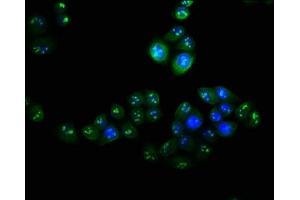 Immunofluorescence staining of Hela cells with ABIN7175336 at 1:100, counter-stained with DAPI.