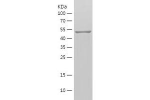 Matrix Metalloproteinase 2 (MMP2) (AA 424-660) protein (His-IF2DI Tag)