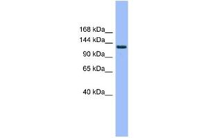 WB Suggested Anti-EVI1 Antibody Titration: 0. (MECOM anticorps  (Middle Region))