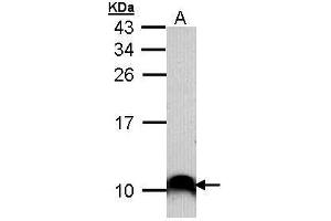 WB Image Sample (30 ug of whole cell lysate) A: A431 , 15% SDS PAGE antibody diluted at 1:1000 (COX7B2 anticorps)