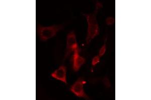 ABIN6274644 staining HeLa cells by IF/ICC.